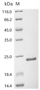 Recombinant Human C-X-C chemokine receptor type 5(CXCR5), partial