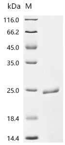 Recombinant Human Augurin(ECRG4), partial