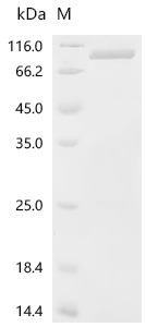 Recombinant Human Importin subunit beta-1 (KPNB1)
