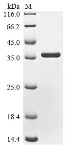 Recombinant Human Protein mono-ADP-ribosyltransferase PARP16 (PARP16), partial