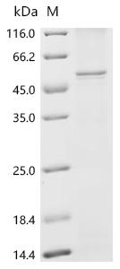 Recombinant Human Secretin receptor (SCTR)