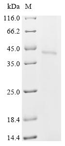 Recombinant Bovine respiratory syncytial virus Major surface glycoprotein G (G)