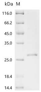 Recombinant Macaca fascicularis Ubiquitin carboxyl-terminal hydrolase isozyme L1 (UCHL1), partial