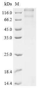 Recombinant Rat Follicle-stimulating hormone receptor (Fshr)