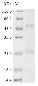 Recombinant Methanobacterium formicicum Probable formate transporter (fdhC)