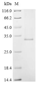 Recombinant Human Very long chain fatty acid elongase 5 (ELOVL5)
