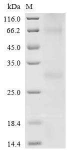 Recombinant Human Melanocortin receptor 5 (MC5R)