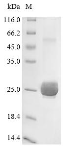 Recombinant Human Aquaporin-5 (AQP5)-Nanodisc