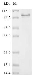Recombinant Rat Reticulophagy regulator 1 (Retreg1)