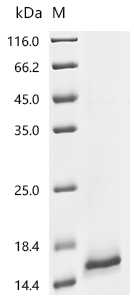 Recombinant Human Uroplakin-2 (UPK2)