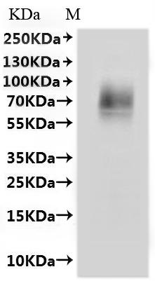 Recombinant Macaca mulatta Solute carrier family 10 member 1 (SLC10A1)-VLPs