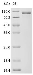 Recombinant Human Procollagen-lysine,2-oxoglutarate 5-dioxygenase 2 (PLOD2)