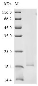 Recombinant Influenza A virus Matrix protein 2 (M2), partial