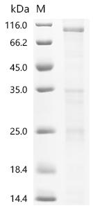 Recombinant Mouse Transient receptor potential cation channel subfamily V member 6 (Trpv6)