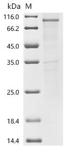 Recombinant Rat Transient receptor potential cation channel subfamily V member 6 (Trpv6)