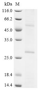 Recombinant Human Putative palmitoyltransferase ZDHHC22 (ZDHHC22)