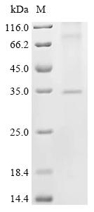 Recombinant Human Voltage-dependent calcium channel gamma-3 subunit (CACNG3)