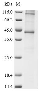 Recombinant Human C-C chemokine receptor type 1 (CCR1)