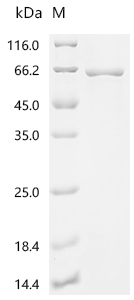 Recombinant Human T-complex protein 1 subunit beta (CCT2)