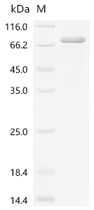 Recombinant Human Suppressor of cytokine signaling 6 (SOCS6)