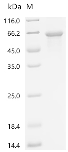 Recombinant Human E3 ubiquitin-protein ligase TRIM11 (TRIM11)