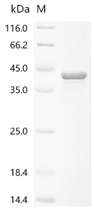 Recombinant Spirometra erinaceieuropaei Cysteine proteinase