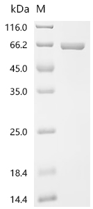 Recombinant Ustilaginoidea virens Phosphoacetylglucosamine mutase