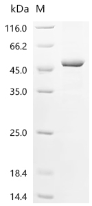 Recombinant Human F-box only protein 22 (FBXO22)