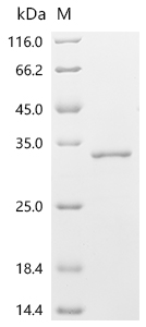 Recombinant Human ADP-ribosylation factor-like protein 4D (ARL4D)