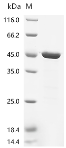 Recombinant Measles virus Nucleoprotein (N), partial