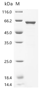Recombinant Human Signal recognition particle subunit SRP54 (SRP54)