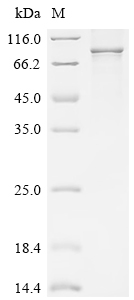 Recombinant Human Sentrin-specific protease 1 (SENP1)