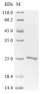 Recombinant Human Focadhesin (FOCAD), partial