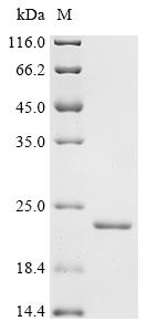 Recombinant Human Bromodomain adjacent to zinc finger domain protein 2B (BAZ2B), partial