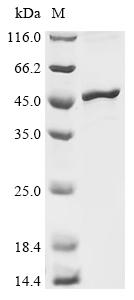 Recombinant Rice tungro bacilliform virus Polyprotein, partial