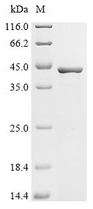Recombinant Spirometra erinaceieuropaei Cysteine proteinase