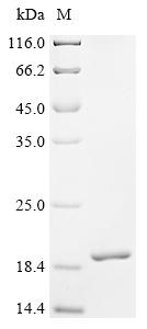 Recombinant Chicken AMP deaminase 1 (AMPD1)
