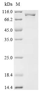 Recombinant Human Putative exonuclease GOR (REXO1L1P)