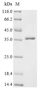 Recombinant Bombyx mori nuclear polyhedrosis virus Polyhedrin (PH)