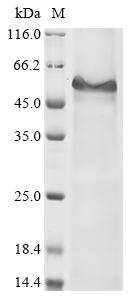 Recombinant Human Thyroglobulin (TG), partial