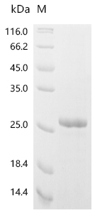 Recombinant Mouse C-C chemokine receptor type 5 (Ccr5), partial
