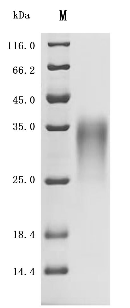 Recombinant Mouse Activin receptor type-2B (Acvr2b), partial