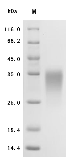 Recombinant Human Activin receptor type-2A (ACVR2A), partial (Active)