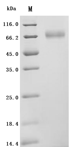 Recombinant Mouse Atrial natriuretic peptide receptor 1 (Npr1), partial
