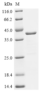 Recombinant Human cDNA FLJ11751 fis, clone HEMBA1005576, moderately similar to Mus musculus plexin 2 (H11Y,S17F)