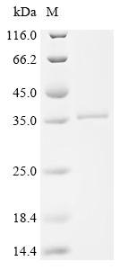 Recombinant Human Cathepsin G (CTSG)