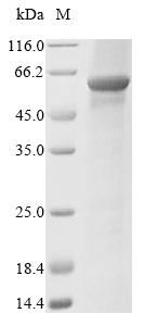 Recombinant Human Propionyl-CoA carboxylase beta chain, mitochondrial (PCCB)