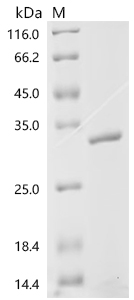 Recombinant Human Stathmin-2 (STMN2)
