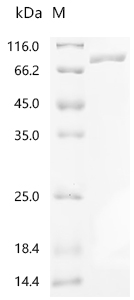 Recombinant Human Propionyl-CoA carboxylase alpha chain, mitochondrial (PCCA)