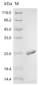 Recombinant Escherichia coli Superoxide dismutase [Mn] (sodA)